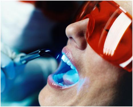 Teeth Whitening clareamento-sorridere