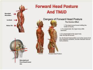 Posture Posture