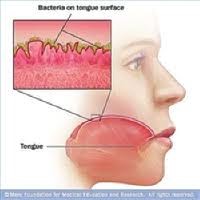 Seattle-holistic-dentistry-bad-breath-diabetes